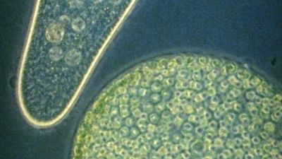Observe protozoan microorganisms from a drop of pond water under optical and electron microscopes