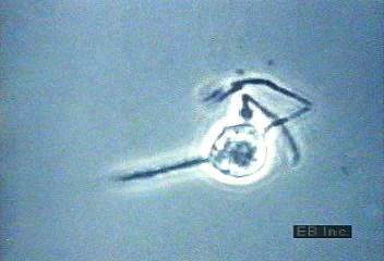 macrophage